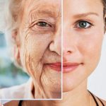 prevent the signs of aging